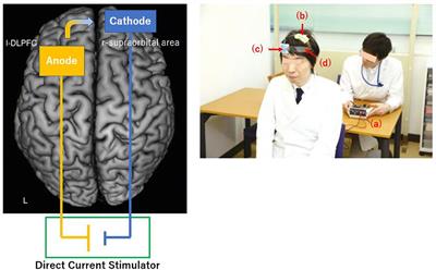 Neurobiological Mechanisms of Transcranial Direct Current Stimulation for Psychiatric Disorders; Neurophysiological, Chemical, and Anatomical Considerations